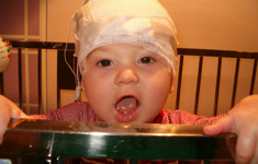 Child with head bandaged