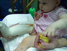 Baby with a cast