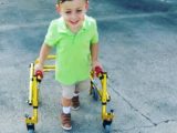 Speech Apraxia and How Sign Language Changed Our World